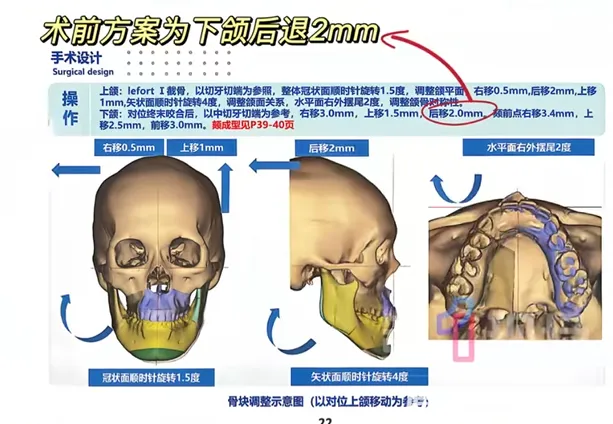 aKDSOQgt0GKrpe7WxxQ0pv9lVwdicia9CPlFLDwSjbXIxNGOglUovUH5DXcFh9CdfcdzAwsxR1B96ohleAndnccDic8Vrlzq7F33vJic0bquF9M.png