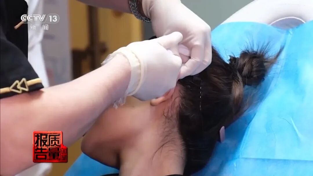 “麻药一过，生不如死”，央视曝光“精灵耳”整形乱象！一女子注射后完全面瘫，错过最佳抢救时间，神经功能恢复渺茫 (http://www.photoreceiver.com/) 财经 第9张